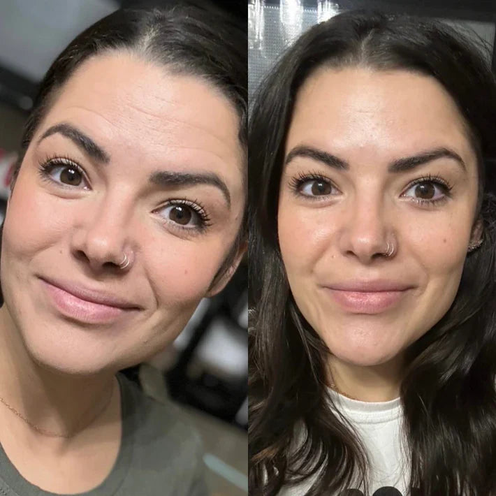 FEROUX™ Silicone Scar Sheets