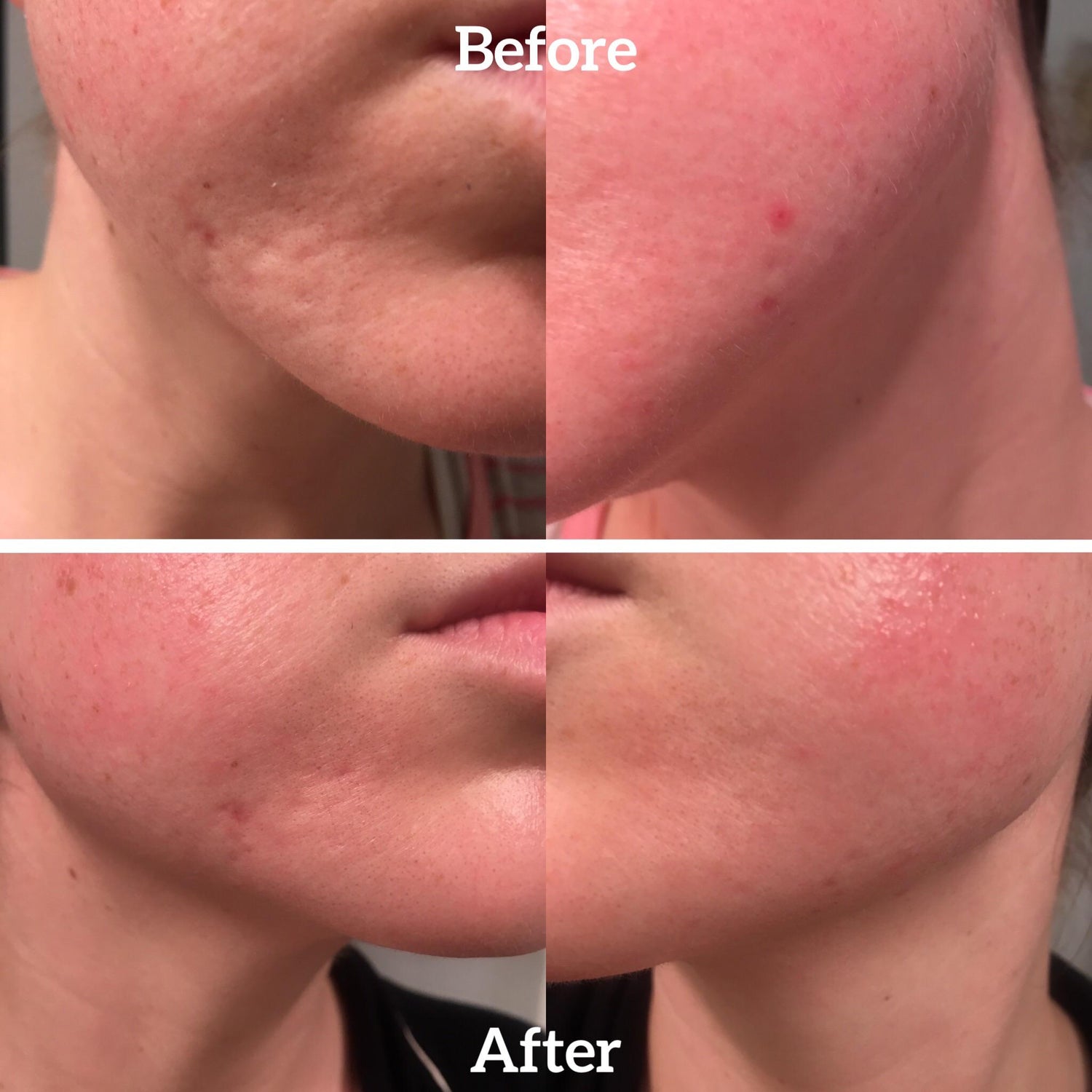 FEROUX™ Silicone Scar Sheets